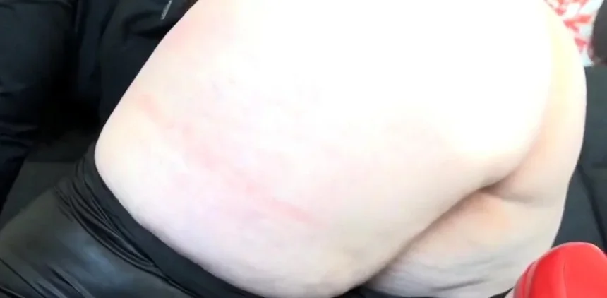 Taylor-Burton – Perverse EKELaufgabe