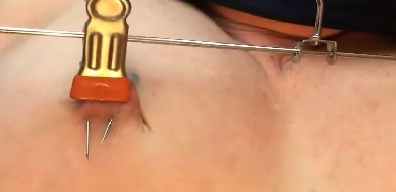 Slave Nippel Breast Torture Stretching Needle