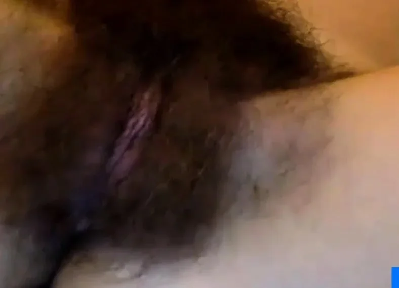 Extremely hairy!