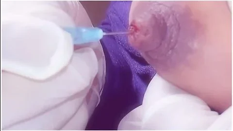 Big nipple needle play