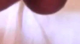 anal
