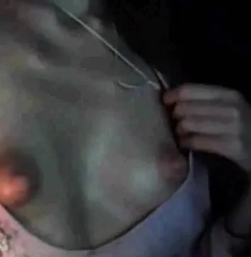 Puffy nipples