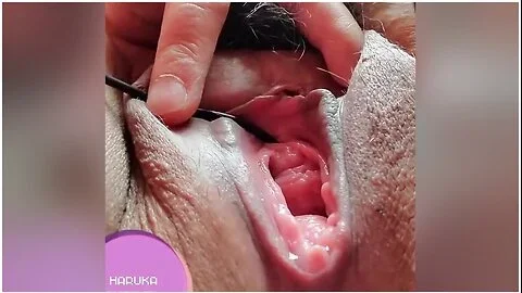 ひとりえっち10 溜まり溜まったまんこみるくかたんたんあふれてくる潮吹きも尿道にイヤフォンシャック責めハイフてスコスコ最後は吸引ハイフてクリ責めしてイくよ