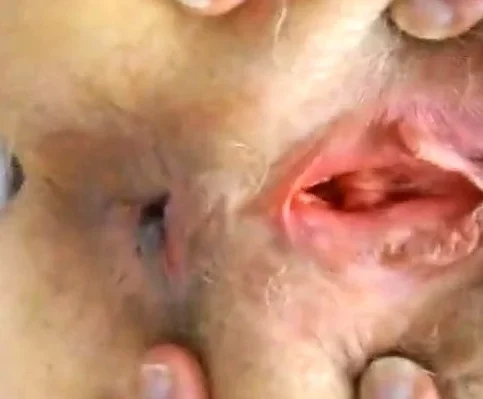Hairy Mature