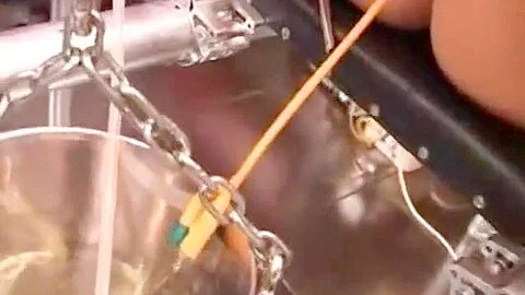 Bladder filling through catheter