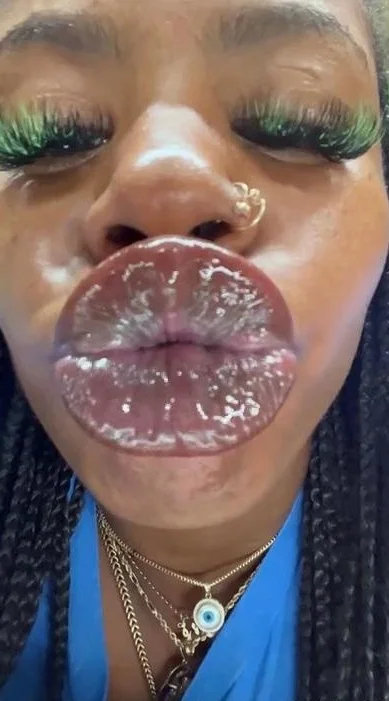 Biiggjuiccyfruit aka biiggjuiccyfruit OnlyFans - Upclose