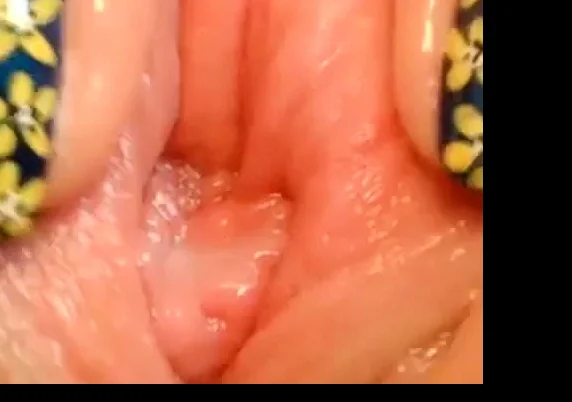 pussy close up and speculum