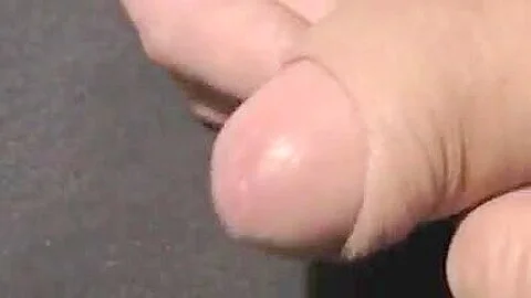 Foreskin playing 264