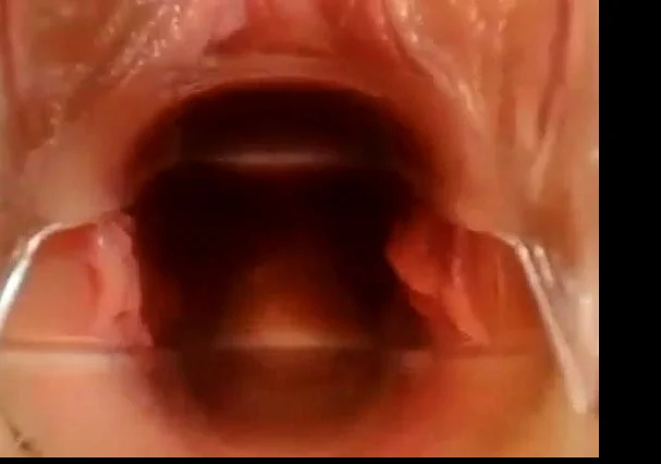 pussy close up and speculum