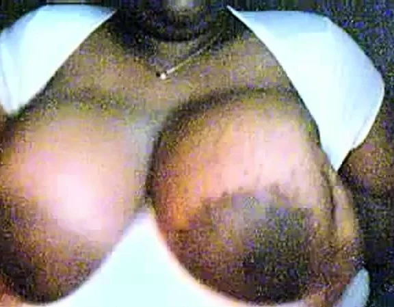 big dark areola