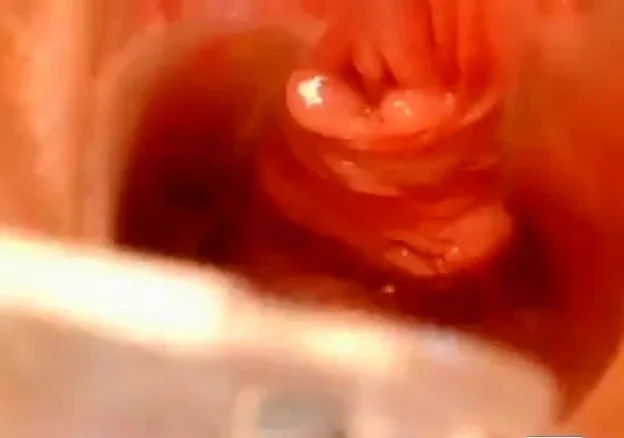 pussy close up and speculum