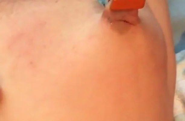 Slave Nippel Breast Torture Stretching Needle
