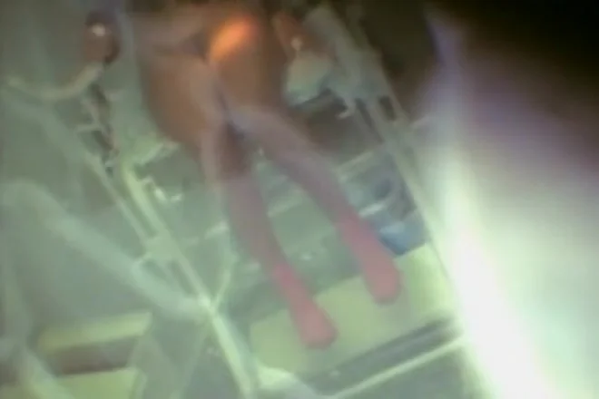 Teenage vagina spied during gyno exam