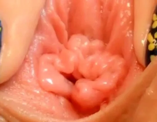 pussy close up and speculum