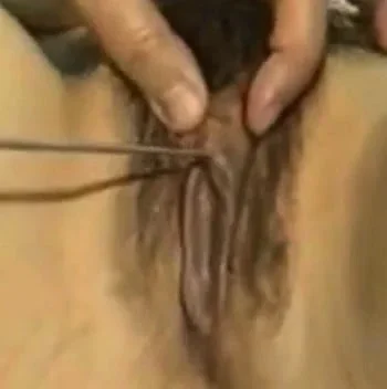 gynecologist