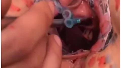 Torture Galaxy - Cunt Torture Extreme