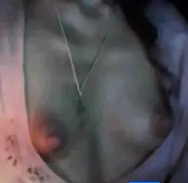 Puffy nipples