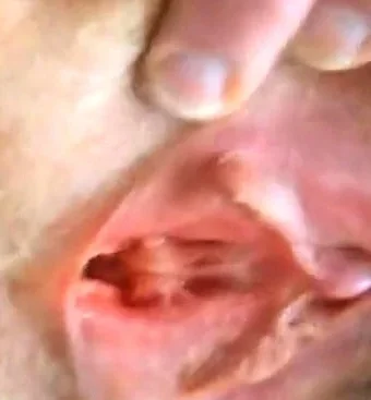 Hairy Mature