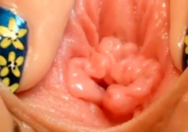 pussy close up and speculum