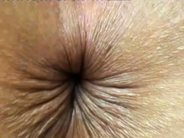 close up butthole winking