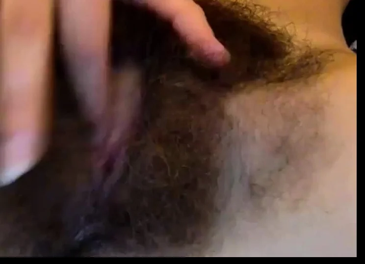 Extremely hairy!