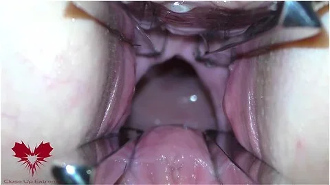 The Mistress Cunt Is Opened With A Hole Expander So That You Can Study Her Cervix