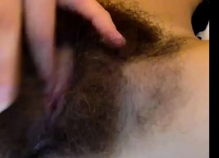 Extremely hairy!