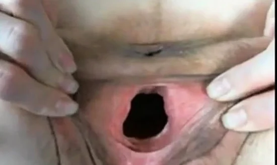 Stretched Pussy Right After Birth
