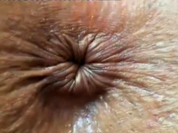 close up butthole winking