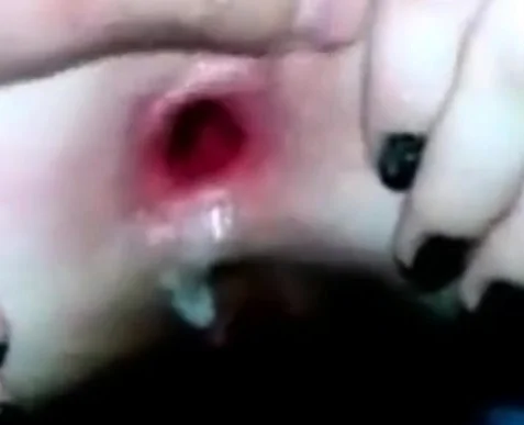 Huge butt hole enormous dildo in ass