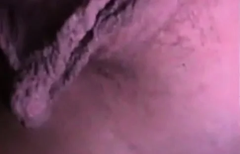 Thought I'd Seen it All: Amateur Close-Up Webcam Edition
