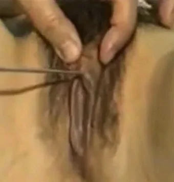 gynecologist