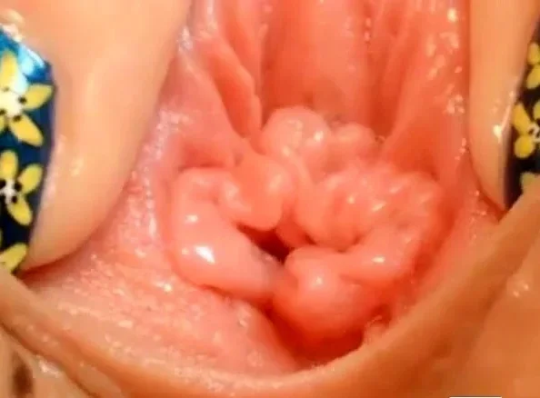 pussy close up and speculum