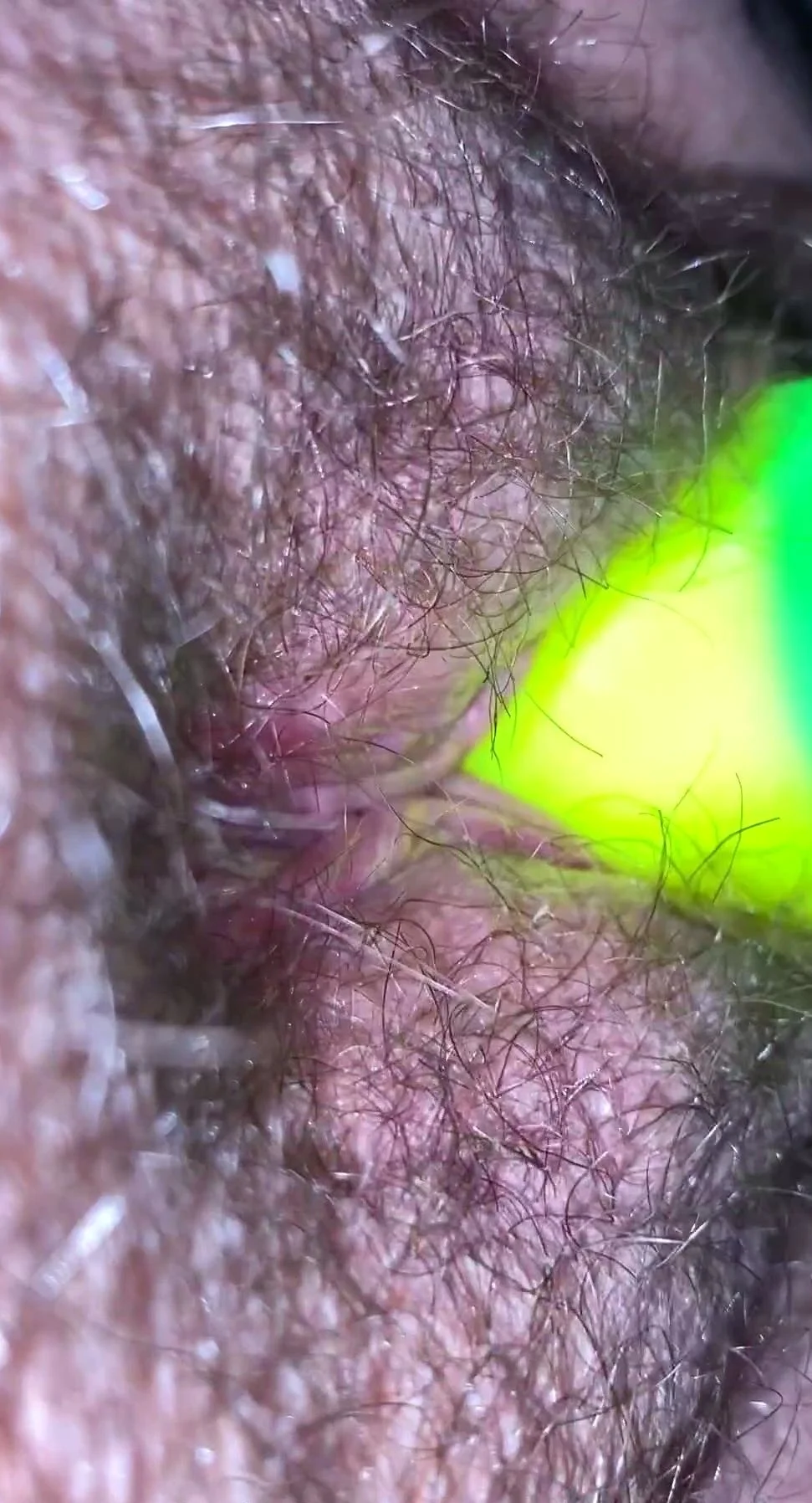 Amateur close up hairy pussy PinkClit
