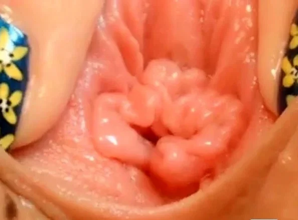 pussy close up and speculum