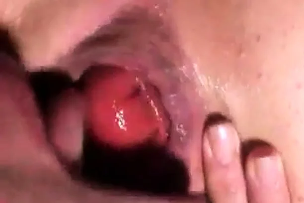 Prolapse licking