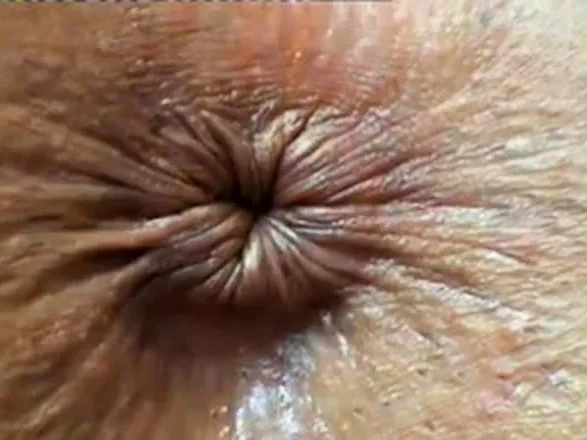 close up butthole winking