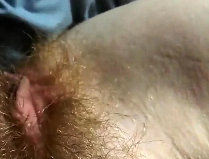 hairy redhead