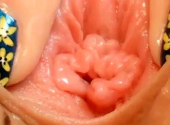 pussy close up and speculum