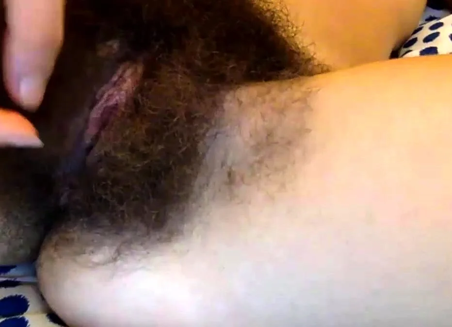Extremely hairy!